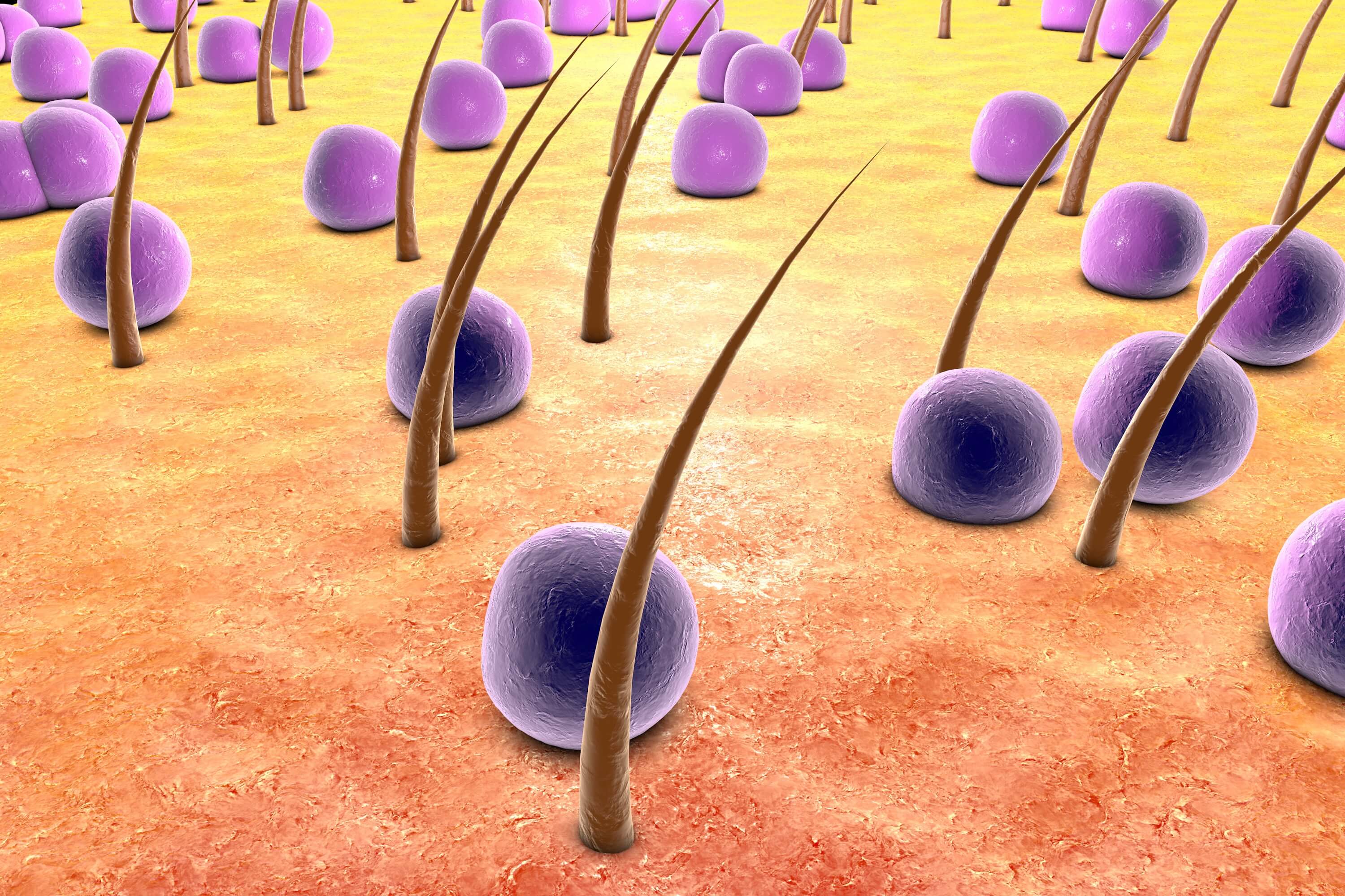 頭皮のにおいは皮脂の異常のサイン 頭のにおいを改善させる3つの方法 薄毛 抜け毛研究所