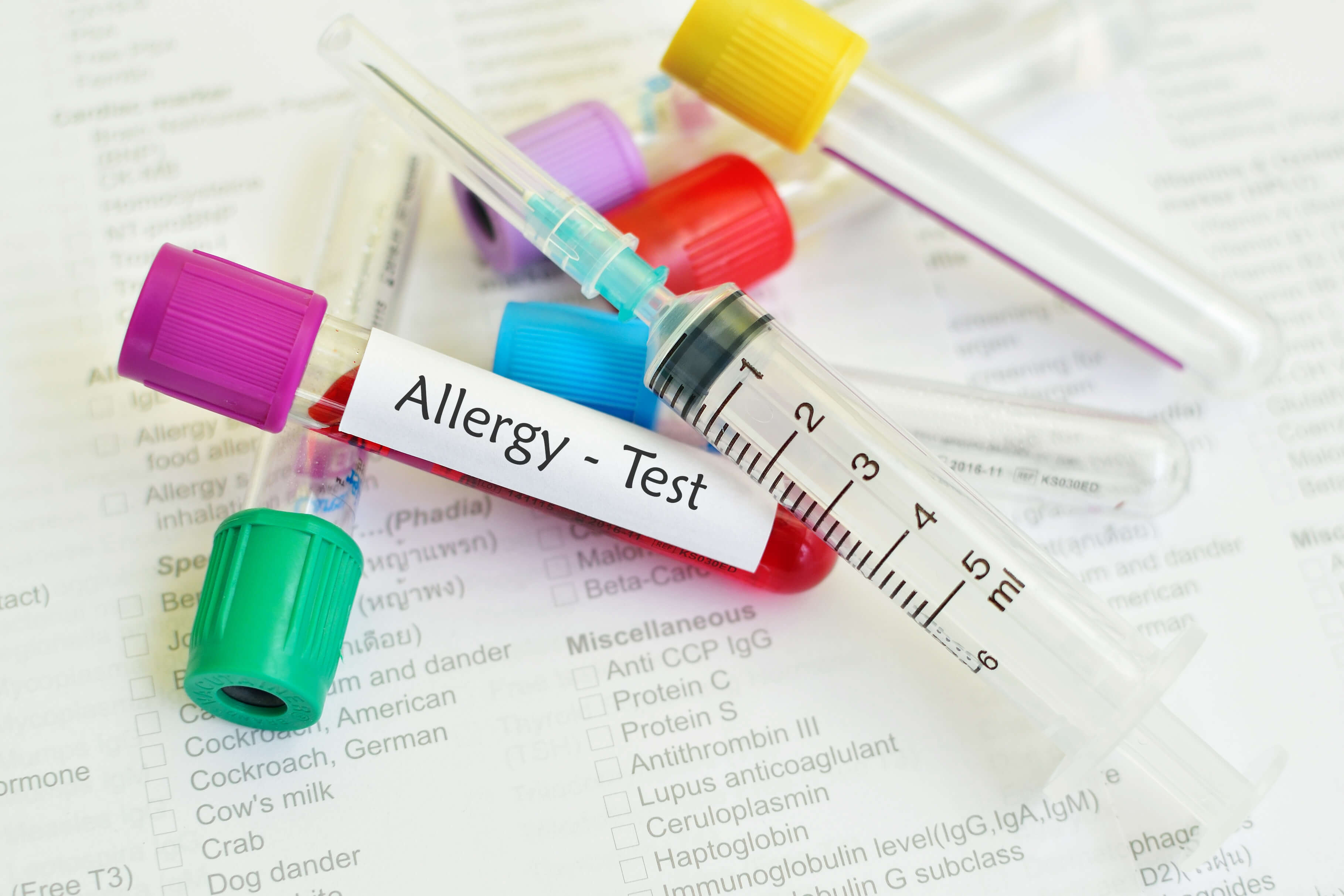 アレルギーテストの為の試験管と注射器