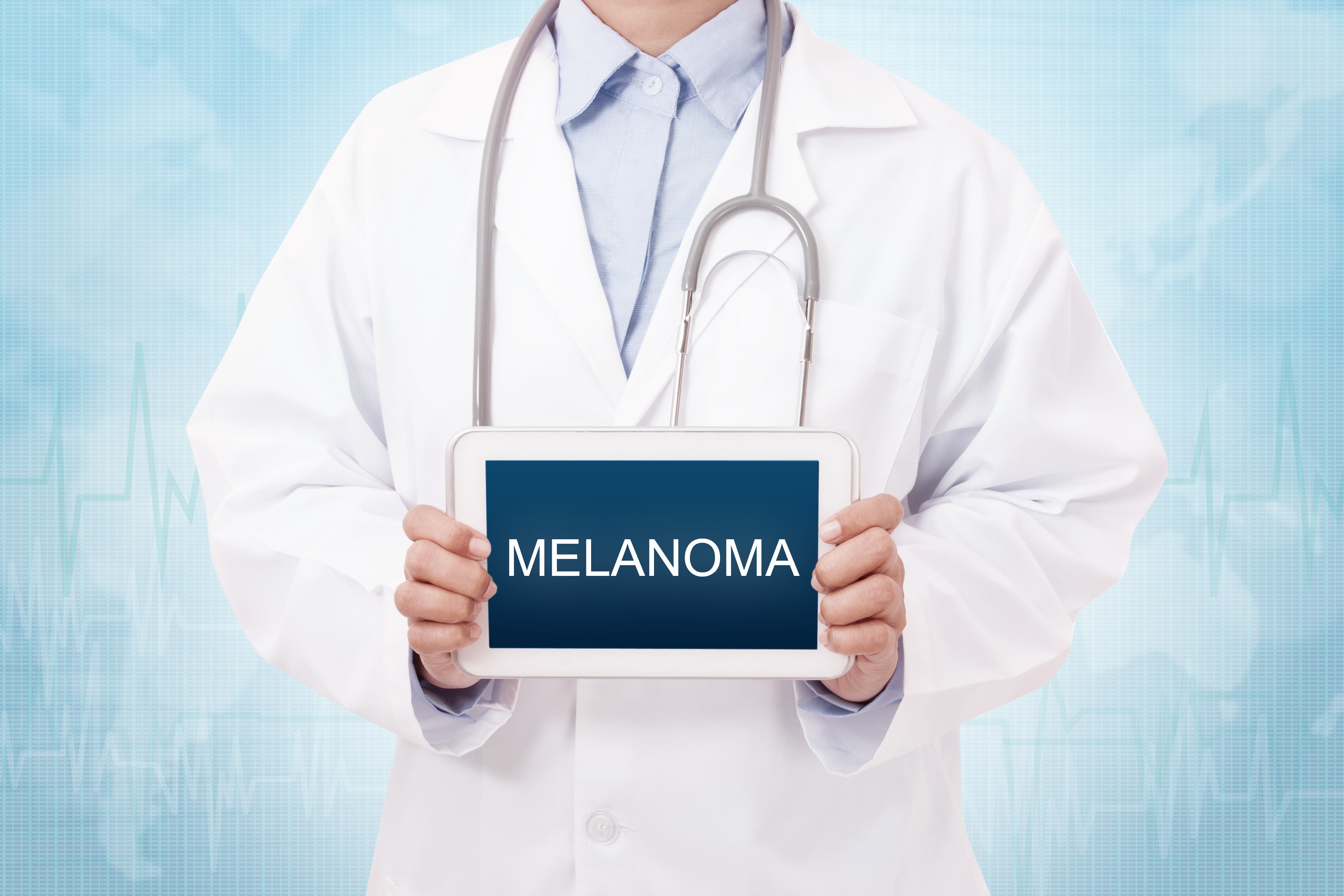 melanomaと書かれたものを持つ医師