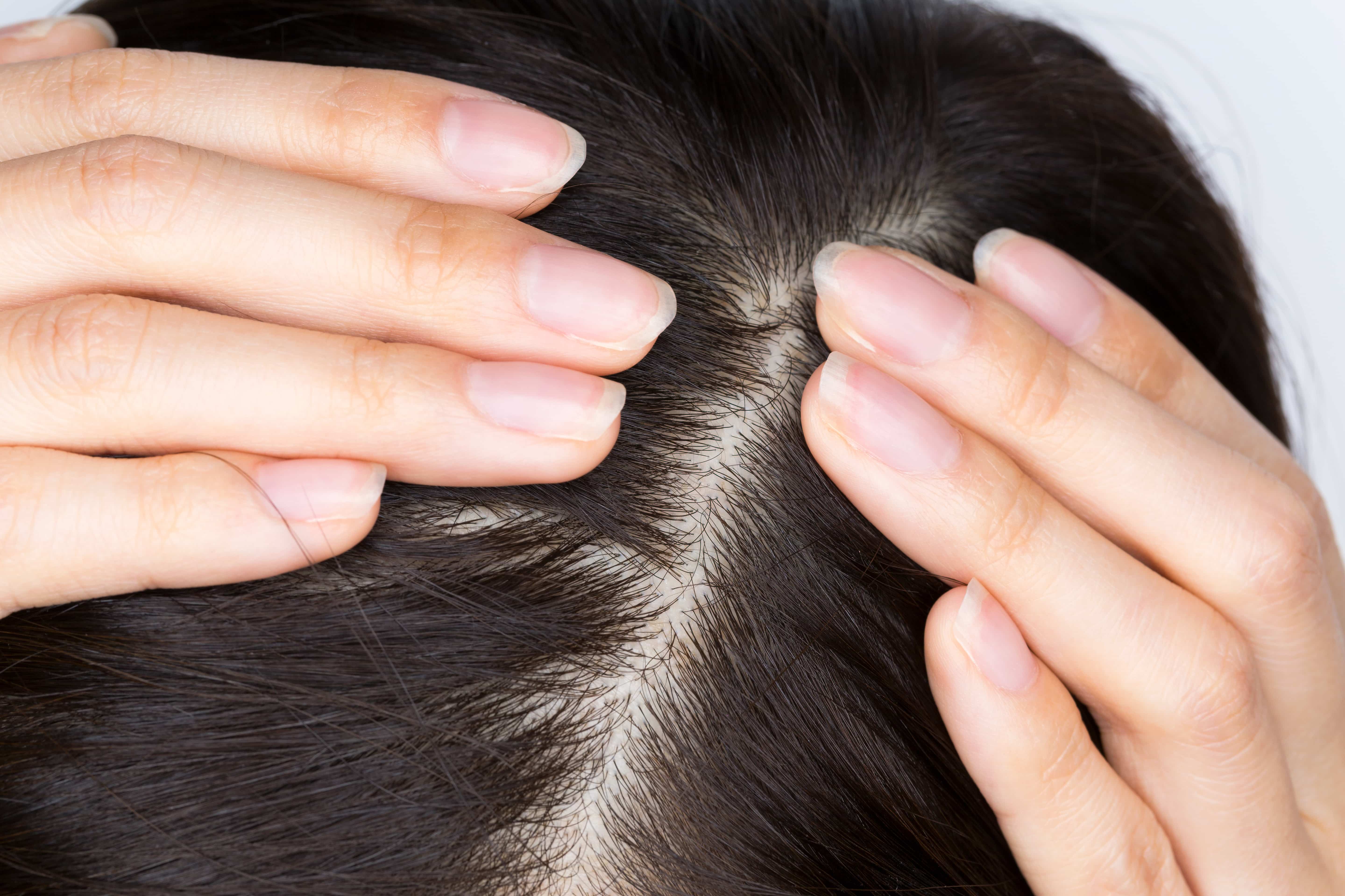 頭皮や髪への影響は ボタニカルシャンプーは薄毛 髪の傷みにも効果的 薄毛 抜け毛研究所