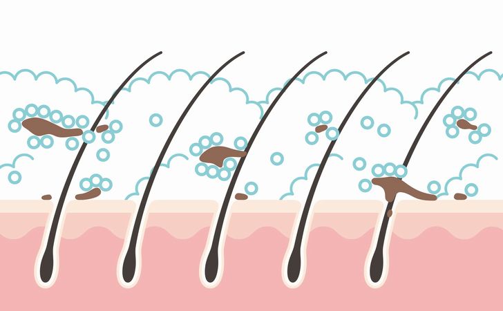 正しいシャンプーで臭いは抑えられる？