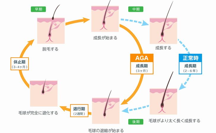 毛根に色素が残ってしまう原因