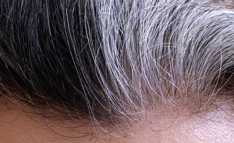 白髪が固まって生えるのはなぜ 白髪の生える位置が意味すること 薄毛 抜け毛研究所