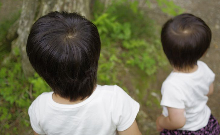 つむじの髪が薄い つむじから薄毛や抜け毛が起こる原因とは 薄毛 抜け毛研究所