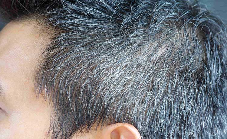 薄毛の進行に白髪は関係ある 髪の色が変化する意味は 薄毛 抜け毛研究所
