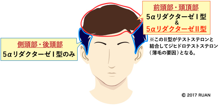 5αリダクターゼ1型2型