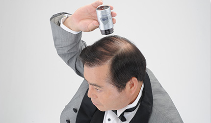 パッチテスト結果