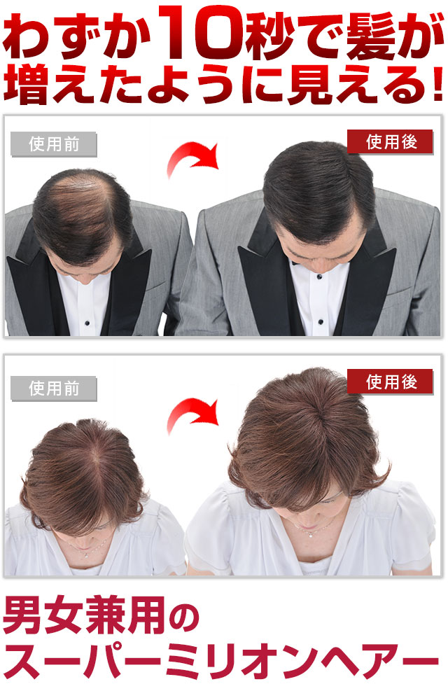 男女兼用のスーパーミリオンヘアー