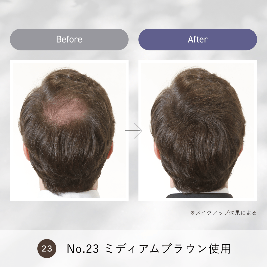 ルアン公式オンラインショップ /スーパーミリオンヘアー