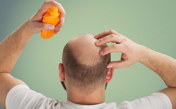 薄毛に効果的な育毛剤